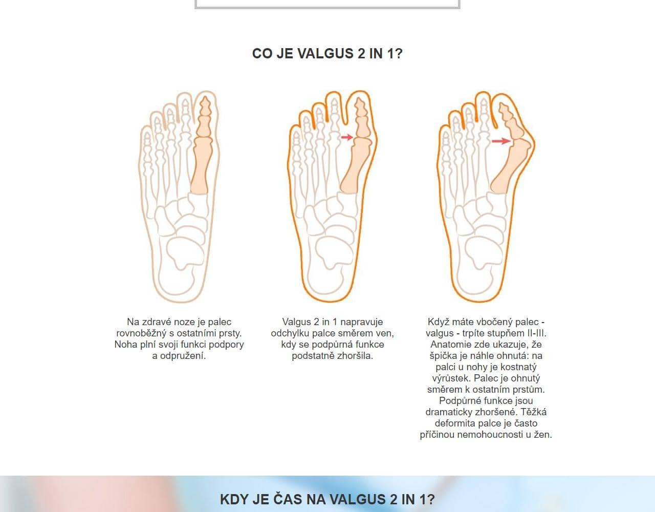 Valgus 3