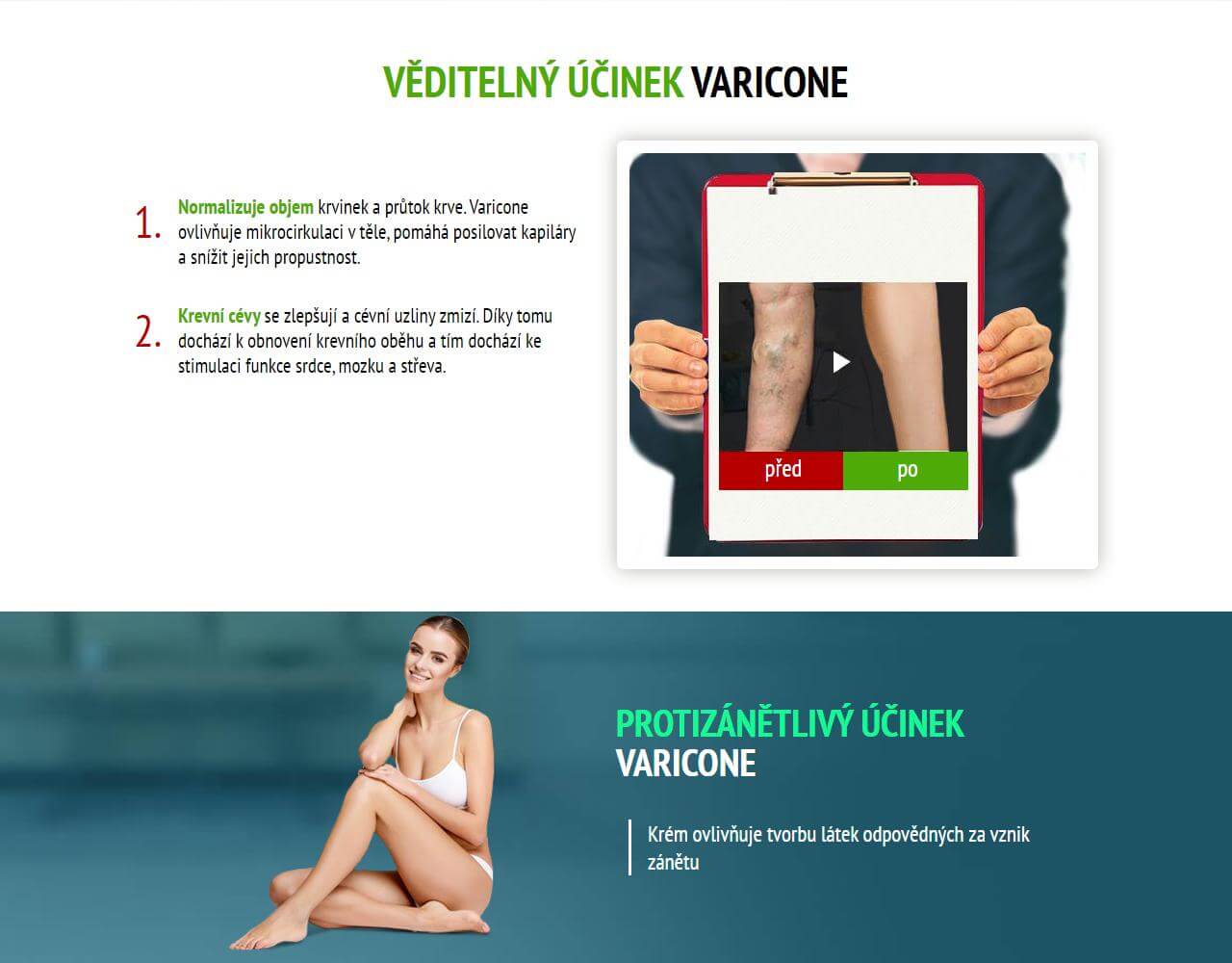 Varicone 4