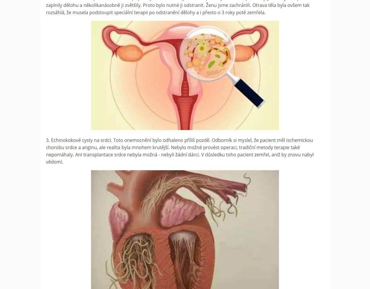 Vermixin 4